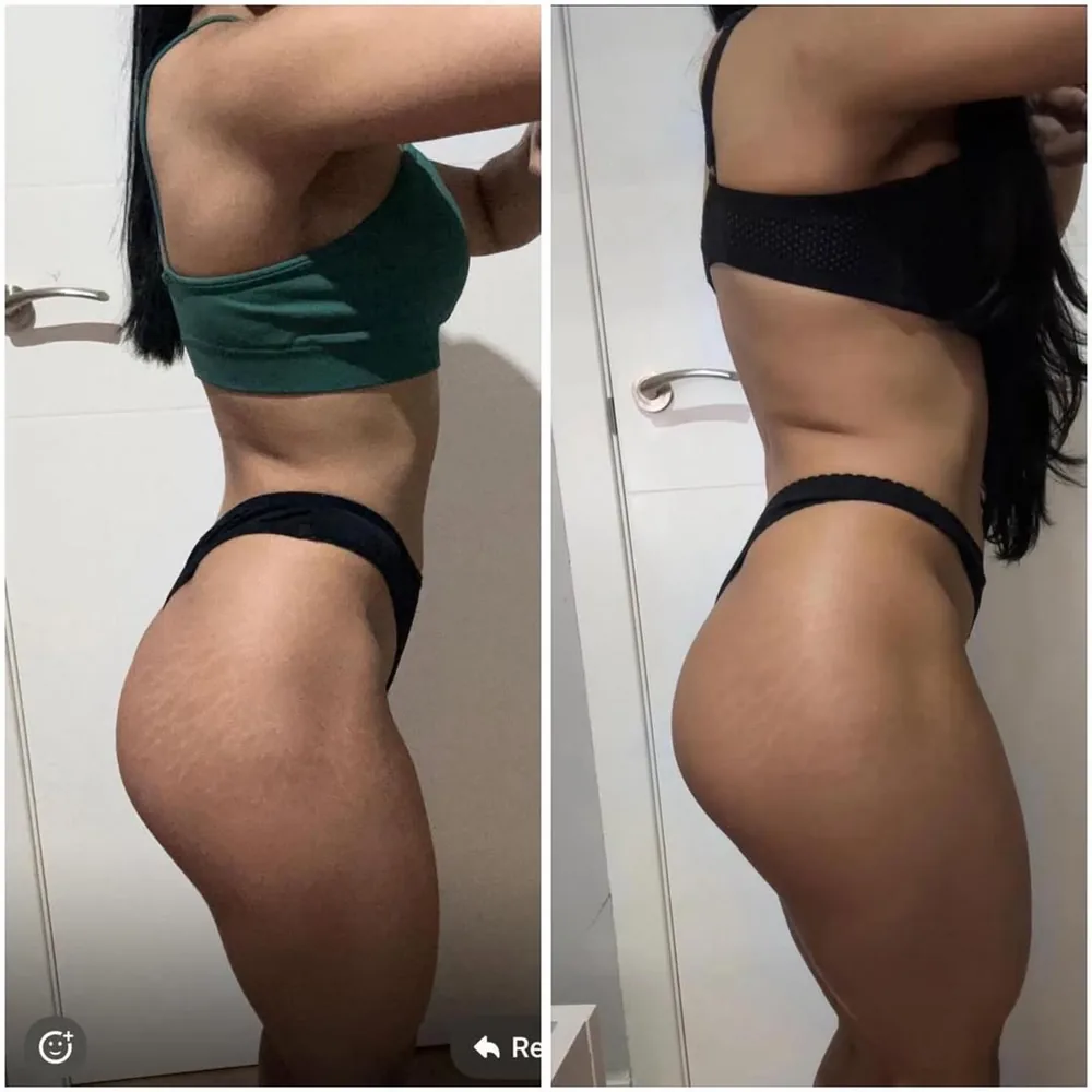 Transformación 1