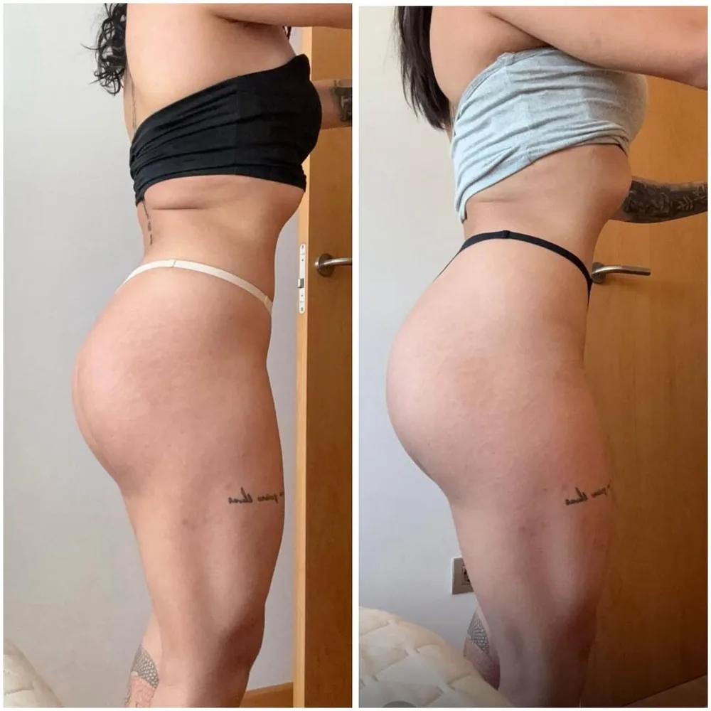 Transformación 2