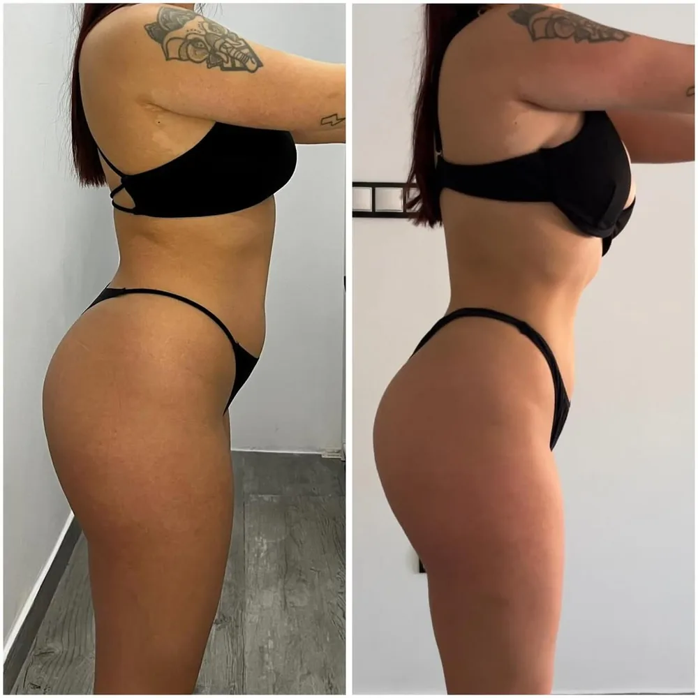 Transformación 5